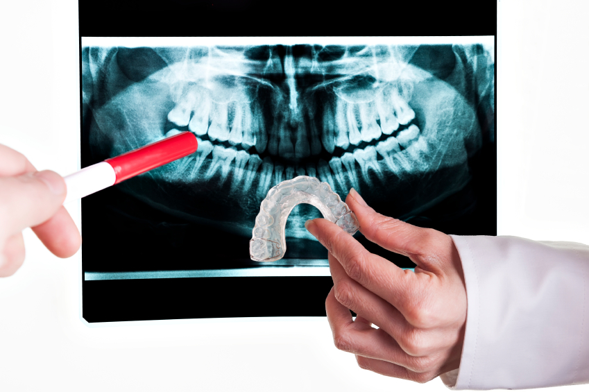 clear correct and invisalign orthodontics
