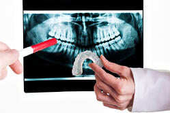 clear correct and invisalign orthodontics