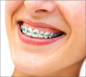 what is orthodontics